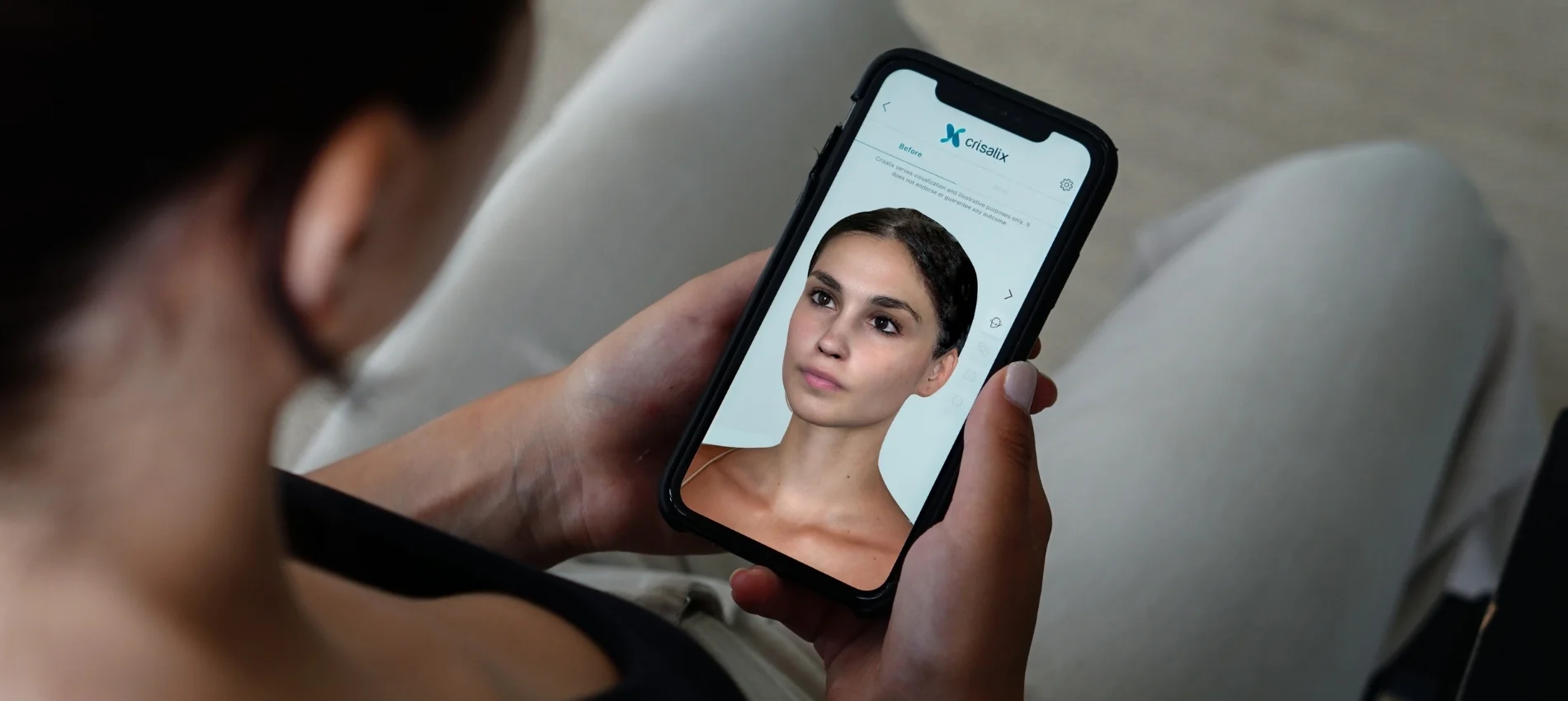 Descubre en segundos el resultado de tu tratamiento con la tecnología Crisalix