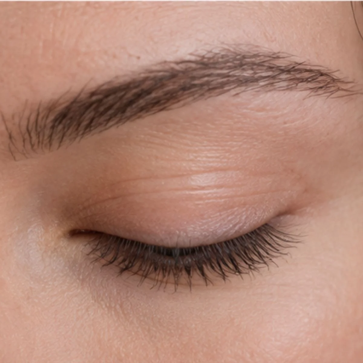 Recuperación y cuidados de la blefaroplastia